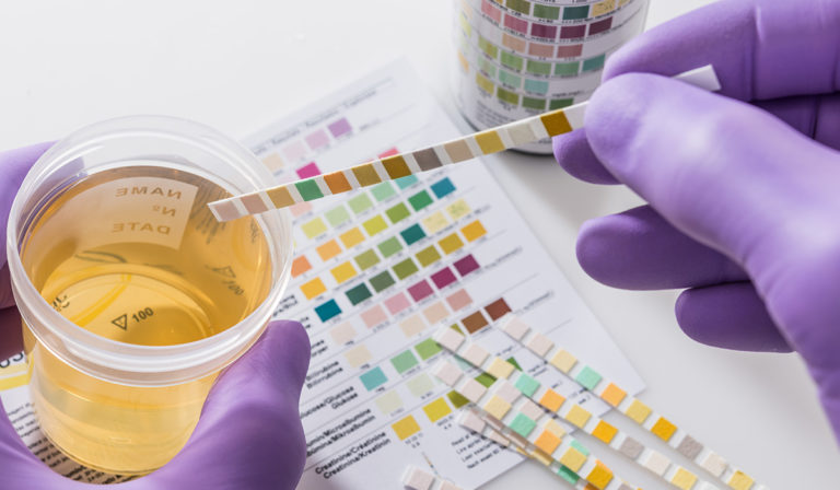 Buscan que SICT obligue a empresas a hacer pruebas toxicológicas a operadores